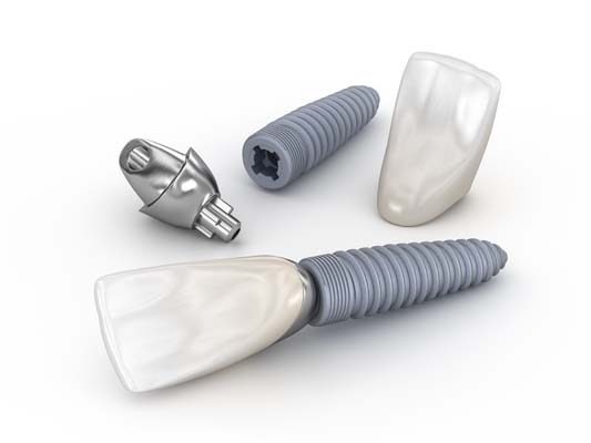 Why Dental Implants Are Comfortable And Secure